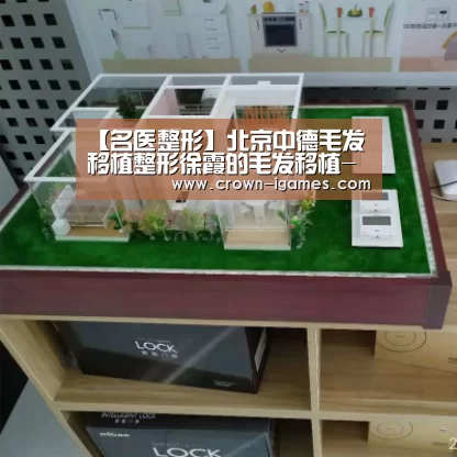 【名医整形】北京中德毛发移植整形徐霞的毛发移植-爱游戏体育下载(图2) 爱游戏体育全站