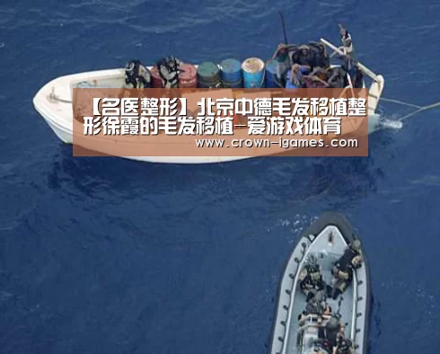【名医整形】北京中德毛发移植整形徐霞的毛发移植-爱游戏体育下载(图1) 【名医整形】北京中德毛发移植整形徐霞的毛发移植-爱游戏体育下载(图1)