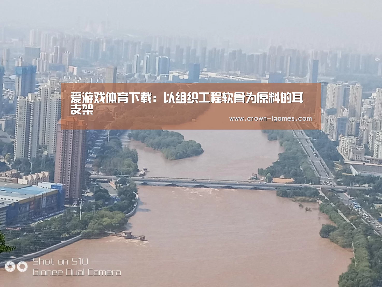 爱游戏体育下载:以组织工程软骨为原料的耳支架(图2) 爱游戏体育下载